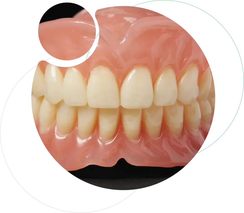 Complete dentures