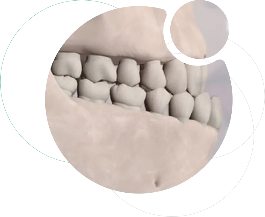 Jaw Deformity Correction Jaw Deformity Correction