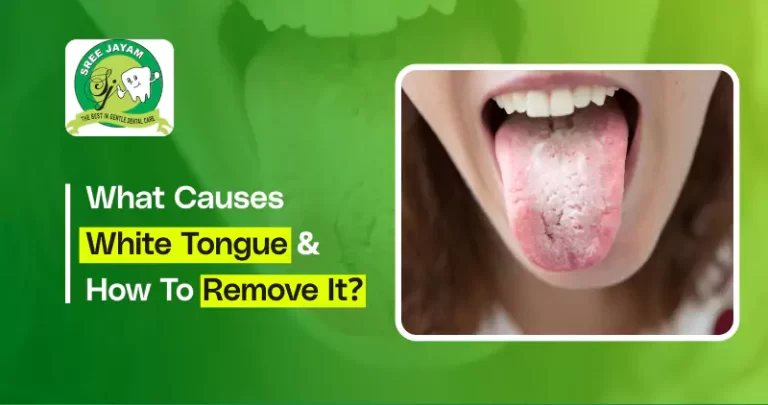 What Causes White Tongue & How to Remove It?