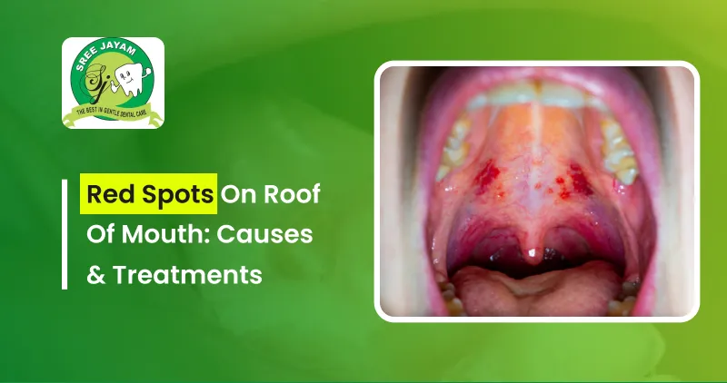 Red Spots on Roof of Mouth Pictures